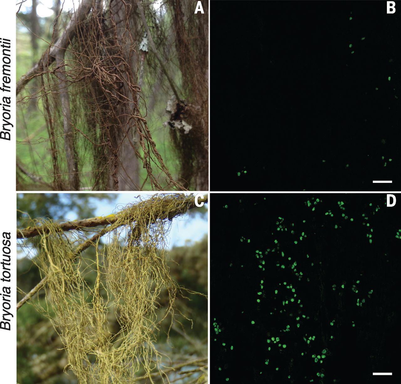Basidiomycete yeasts in the cortex of ascomycete macrolichens